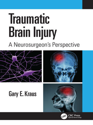 cover image of Traumatic Brain Injury